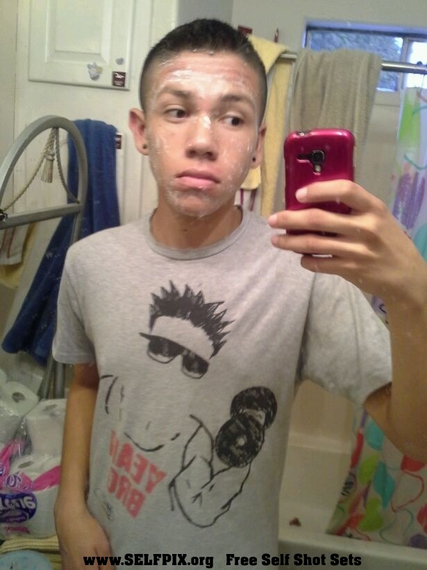 Codys Peeling Self Pic   ^^